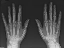 diagnostic-x-ray-imaging