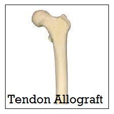 Tendon Allograft