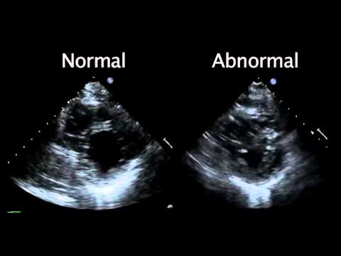 Echocardiography