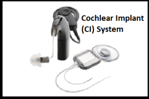 Cochlear Implant (CI) System