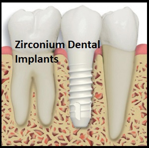 6064-zirconium-dental-implants