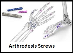 Arthrodesis Screws
