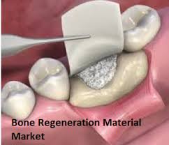 Bone Regeneration Material