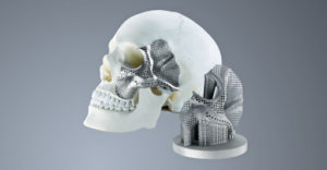 Cranio Maxillofacial Implants