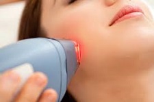 Dermatology Lasers