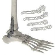 Internal Trauma Fixation Device