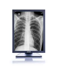 Monochrome Medical Monitor