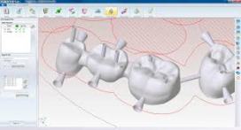 Dental CAD/CAM Software