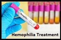 Hemophilia Treatment