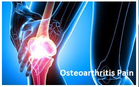 Osteoarthritis Pain