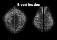 Breast Imaging