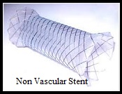 Non Vascular Stent