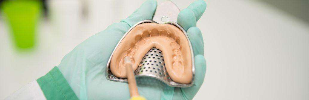 Dental Alginate Impression Materials Market 2021 Report – Dentsply Sirona, GC Corporation, Septodont, Kulzer, Lascod&nbsp;S.p.a.