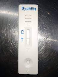 Syphilis Rapid Test Kit Market Report Expected Massive Growth By 2021-2026 | Abbott (Alere), Intec, Beckman Coulter,&nbsp;Bio-Rad