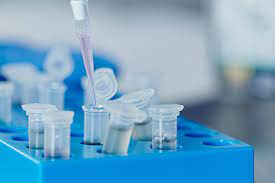 Infectious Disease Diagnostics Testing Market Report Expected Massive Growth By 2021-2026 | Abbott Diagnostic, Bio-Rad Laboratories, Diasorin, Abbott, Becton, Dickinson and&nbsp;Company